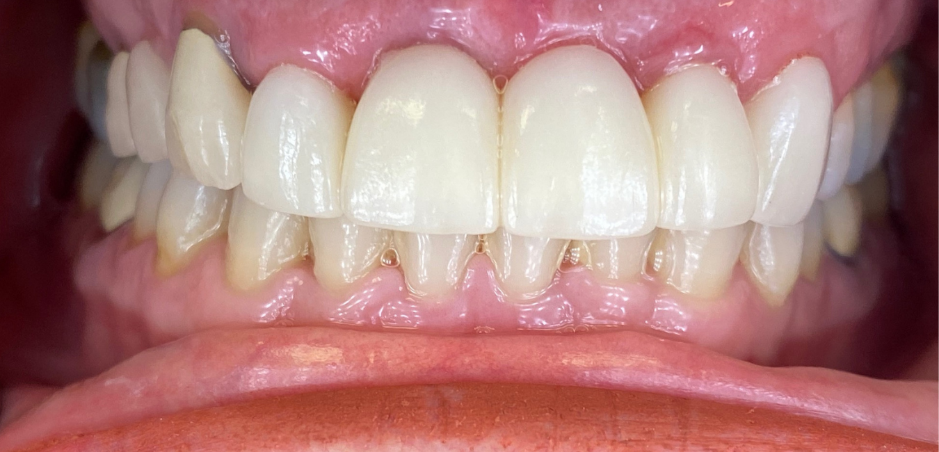 After Portland Cosmetic Dental care
