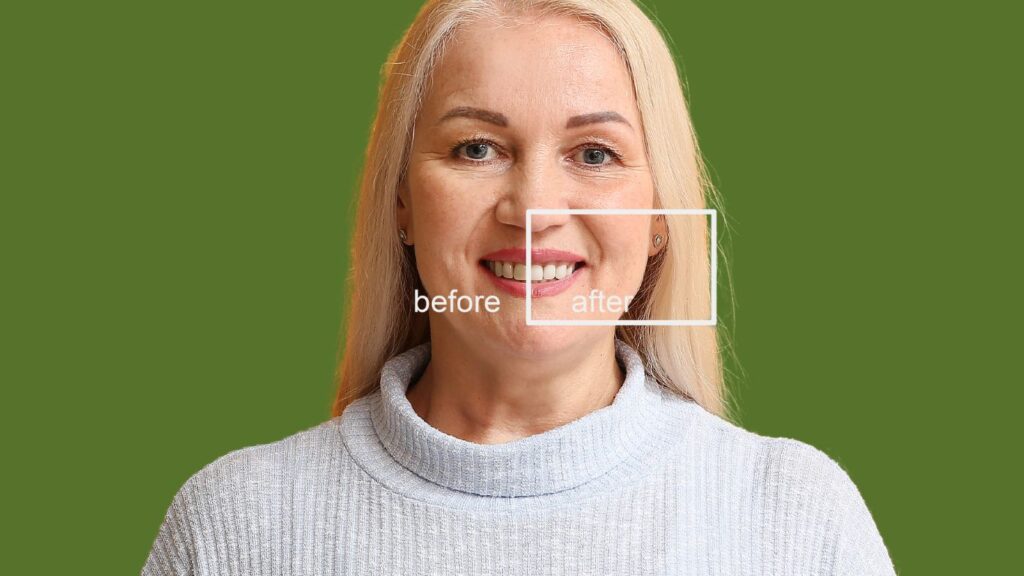 happy mature women before and after laser teeth whitening